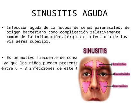 PPTX SINUSITIS AGUDA Y CRONICA DOKUMEN TIPS