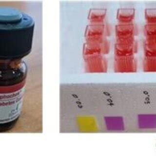 Sample Preparation A Bio Rad Lyphocheck Diabetes Management Bilevel