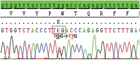 Part Of Dna Sequencing Of The Hbb Gene Hb Alessandria Showing The Download Scientific Diagram