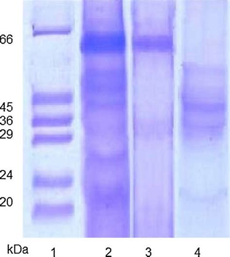 Sds Page Pattern Of Purified Enzymes Lane Marker Lane Crude