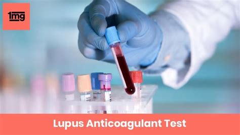 Lupus Anticoagulant (LA, LAC ): Purpose & Normal Range of Results | 1mg