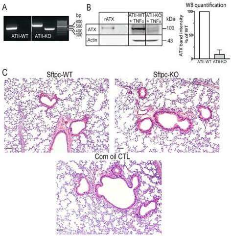 Cancers Free Full Text Prometastatic Effect Of ATX Derived From