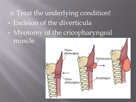 Ppt Diseases Of The Esophagus Powerpoint Presentation Free Download