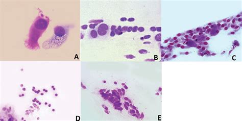 Ciliated Cell And Goblet Cell Obtained By Nasal Scraping Stained