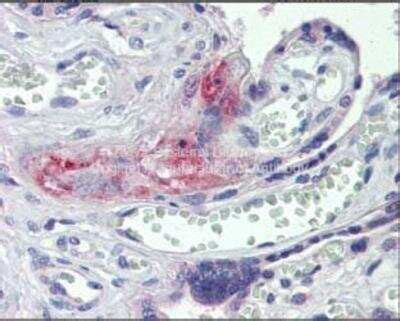 Human Coagulation Factor Ii Thrombin Elisa Kit Colorimetric Nbp