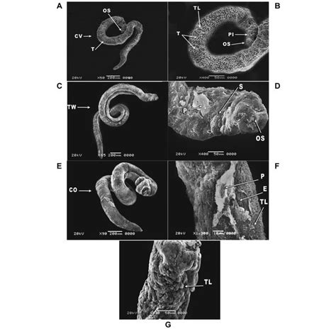 Scanning Electron Microscopy Sem Of Schistosoma Mansoni Juvenile