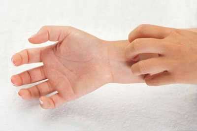 Swollen Itchy Hands: 6 Causes and 14 Treatments