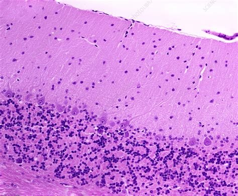 Human Cerebellum Histology