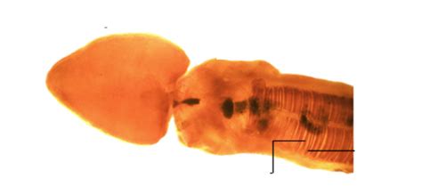 Acorn Worm Diagram Quizlet