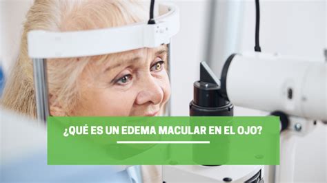 Qué es un Edema Macular en el Ojo Te lo Contamos