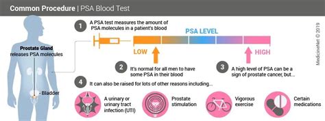 Psa Test Levels Chart A Visual Reference Of Charts Chart Master