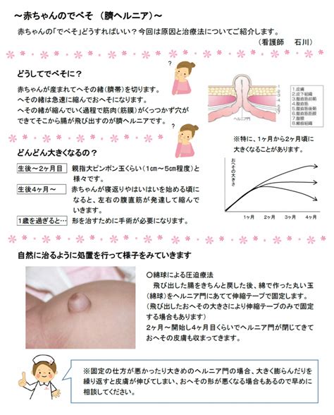 臍ヘルニアでべそ｜丸亀市 小児科 もりもとこどもクリニック