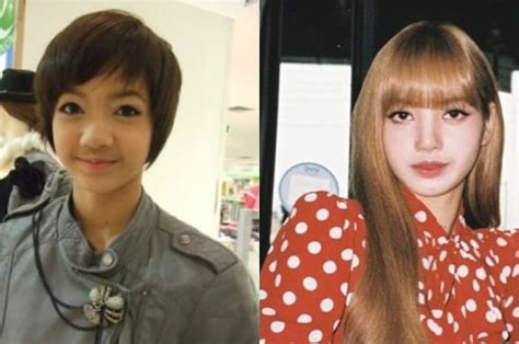 Before After Lisa Blackpink Dugaan Operasi Plastik Terungkap Sonoraid