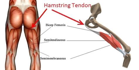 Proximal Hamstring Tendonopathy Rebalance Sports Medicine