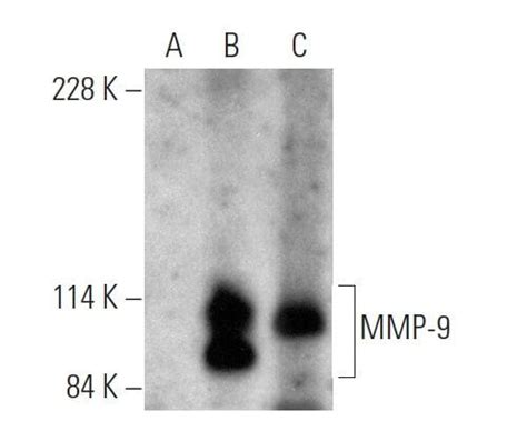 Mmp Antibody E Scbt Santa Cruz Biotechnology