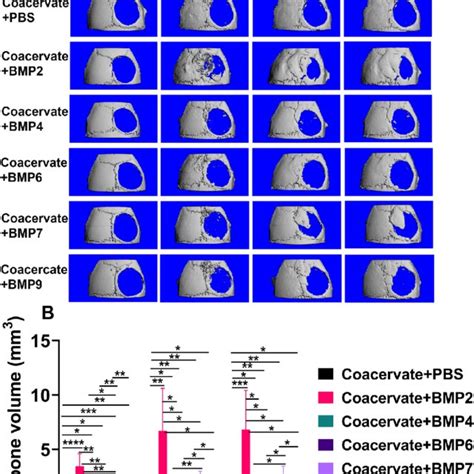 Micro CT Analysis Of In Vivo Bone Regeneration Of Different BMPs Using