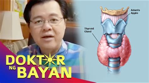 Thyroid Problem Goiter Bukol Sa Leeg Payo Ni Doc Willie Ong 470b