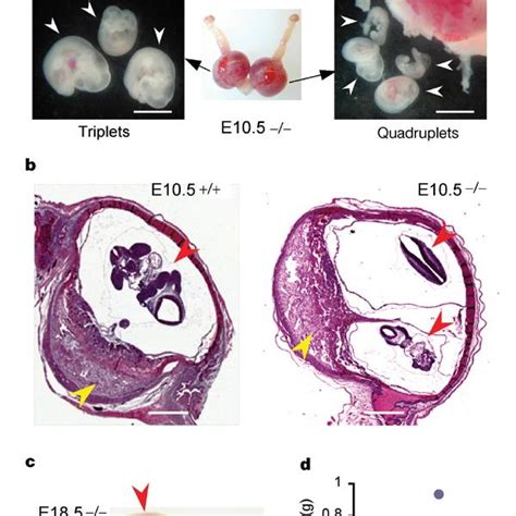 Stages Of Embryo Implantation