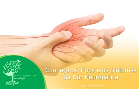 O Que E Dor Neuropatica - Conheça os Tipos e os Sintomas da Dor Neuropática | Neurologia Hoje ...
