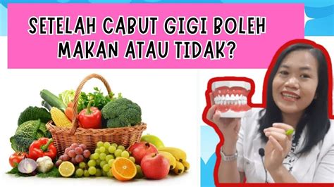 Setelah Cabut Gigi Boleh Makan Gak YouTube