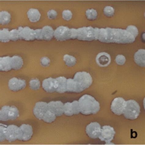 Morphological Characteristics Of Streptomyces Sp Isolates A Spore