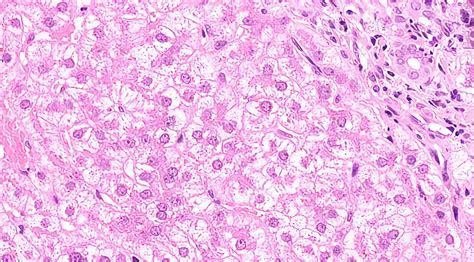 Histology Image 01 | UK Liver Pathology Group