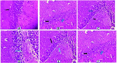 Histopathology of rat brain (Hippocampus section) with H&E ×400. (A ... 