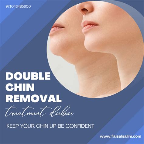 Double chin treatment – Artofit 