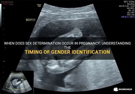 When Does Sex Determination Occur In Pregnancy Understanding The Timing Of Gender