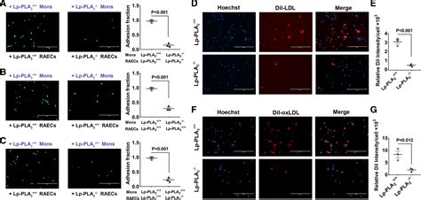 Lp-PLA2 (Lipoprotein-Associated Phospholipase A2) Deficiency Lowers ...