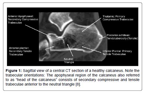 Clinical Research On Foot Ankle Calcaneocuboid Joint Involvement In