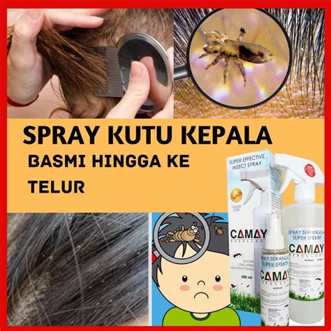 Ubat Kutu Rambut Kepala Natural Head Lice Shopee Malaysia