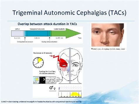 Pathophysiology Structures Related With Headache 2