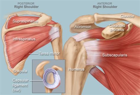 Shoulder Impingement Syndrome Causes Symptoms Treatment Workfitme