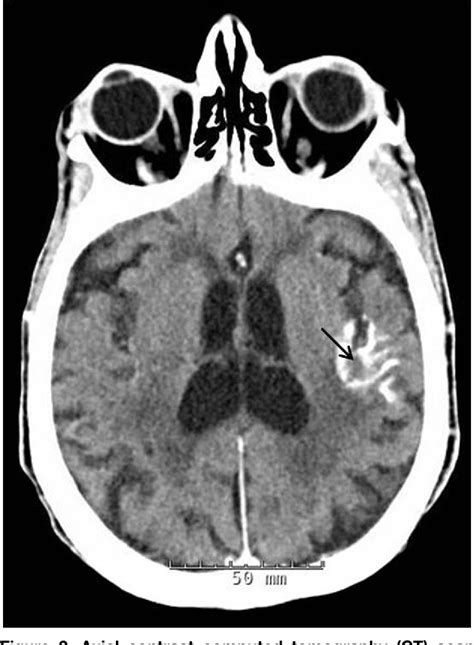 Figure From Visual Diagnosis In Emergency Medicine Gyral