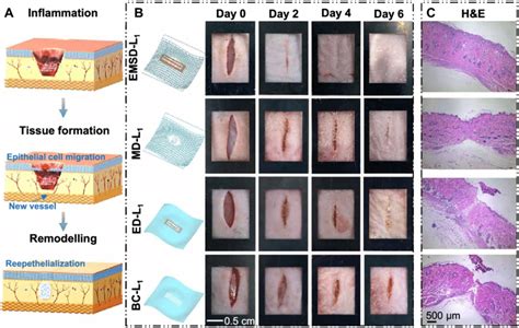 Cascade Stages Of Wound Repair And Linear Incisional Wound Healing A