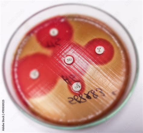 Antimicrobial Susceptibility Testing In Petri Dish Gram Positive Coccus