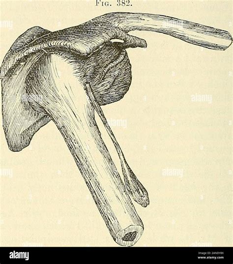 A Practical Treatise On Fractures And Dislocations He Vacated Glenoid Cavity Is Covered By The