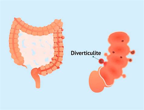 Duoprocto Coloproctologia Brasília Df