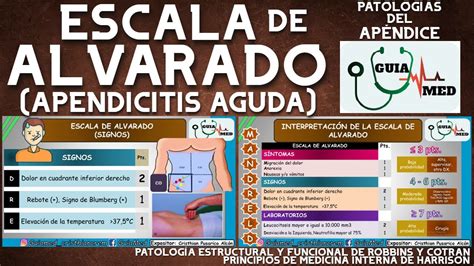 Escala De Alvarado Para Apendicitis Guiamed