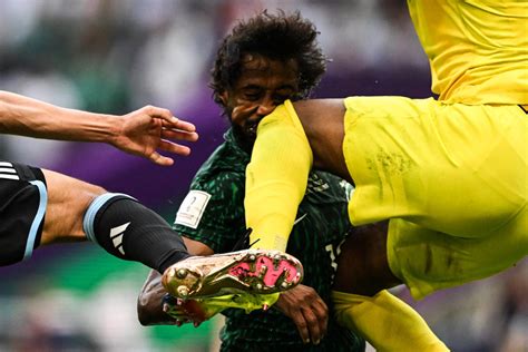 El Futbolista De Arabia Saudita Que Debe Ser Operado De Urgencia El