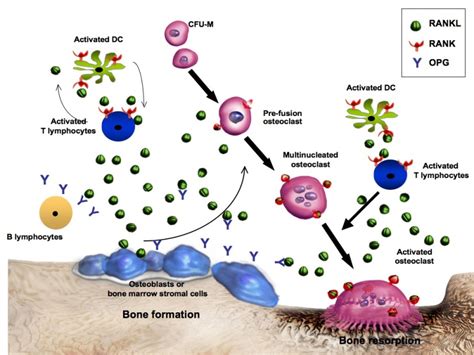 Bone Remodeling Osteoporosis