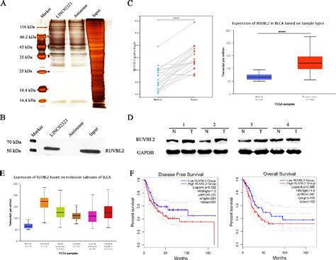 Figure 3 From A Novel LINC02321 Promotes Cell Proliferation And