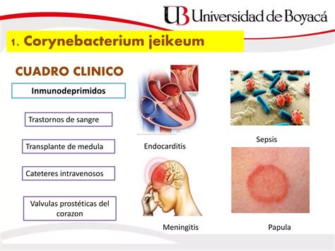 Bacilos Aerobios Gram Positivos Ppt