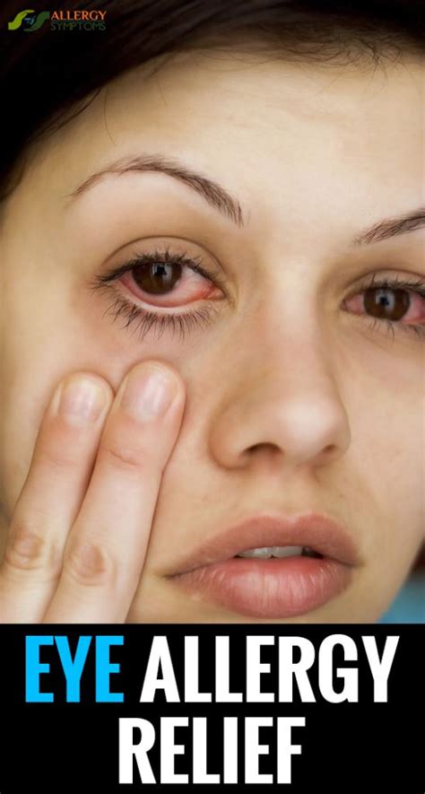 eye allergy symptoms, eye allergy relie, eye allergy