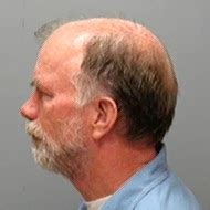 The Adventures Of Johnny Northside Minnesota Level Three Sex Offender Website Goes Down In