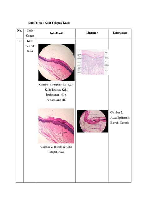 Doc Histologi Kulit Tebal Lapisan Epidermis