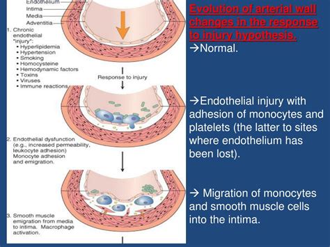 Ppt Atherosclerosis Cvs Lecture 2 Atherosclerosis Powerpoint Presentation Id 2135750