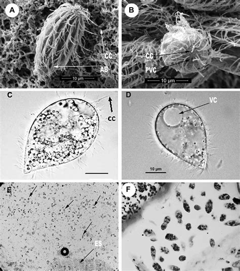 (A) y (B) Microfotografía electrónica de barrido (SEM) mostrando la... | Download Scientific Diagram