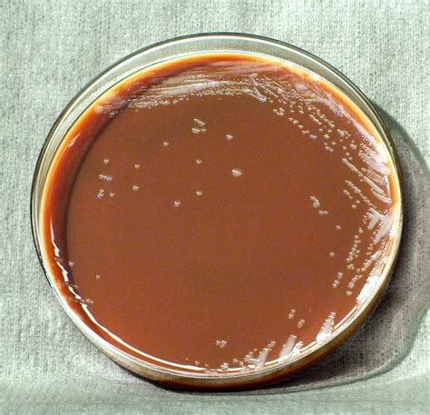 Free picture: francisella, tularensis, bacteria, close